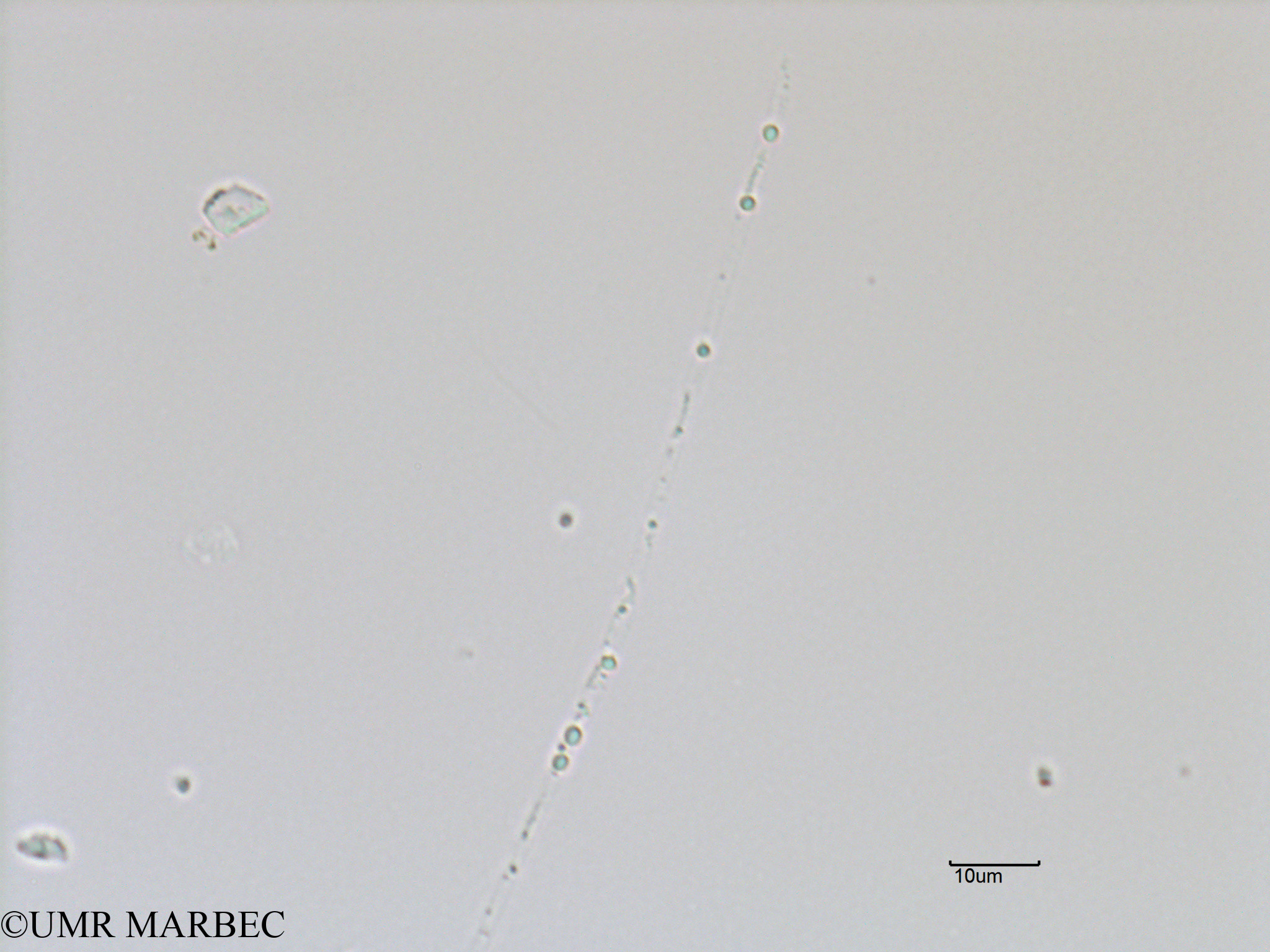 phyto/Bizerte/bizerte_bay/RISCO November 2015/Thalassiothrix mediterranea var. pacifica (Baie_T5-C3-leptocylindrus ou lioloma-5).tif(copy).jpg